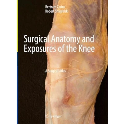 Abbildung von Surgical Anatomy and Exposures of the Knee: A Atlas