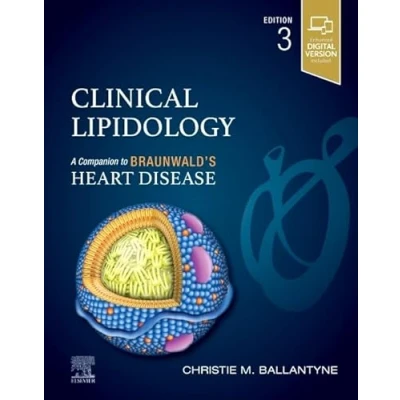 Abbildung von Clinical Lipidology: A Companion to Braunwald’s Heart Disease