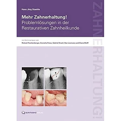 Abbildung von Mehr Zahnerhaltung!: Problemlösungen in der Restaurativen Zahnheilkunde