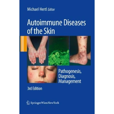 Abbildung von Autoimmune Diseases of the Skin: Pathogenesis, Diagnosis, Management