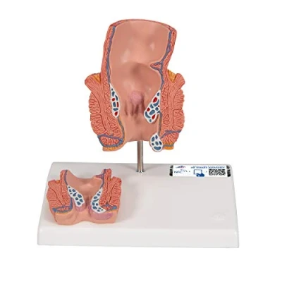 Abbildung von 3B Scientific Menschliche Anatomie Hämorrhoidenmodell + kostenlose App Smart Anatomy
