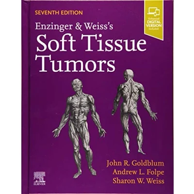 Abbildung von Enzinger and Weiss&#039;s Soft Tissue Tumors: Expert Consult: Online Print