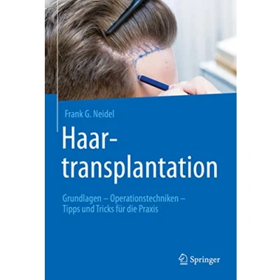 Abbildung von Haartransplantation: Grundlagen Operationstechniken Tipps und Tricks für die Praxis