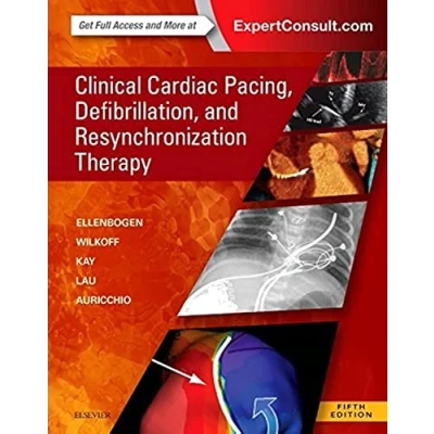 Abbildung von Clinical Cardiac Pacing, Defibrillation and Resynchronization Therapy: Expert Consult Premium Edition Enhanced Online Features Print