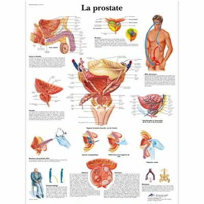Abbildung von 3B Scientific Lehrtaffel laminiert La prostate Französisch