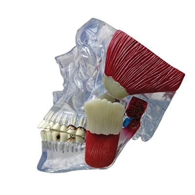 Abbildung von GPI Anatomicals 2880 Kiefergelenk Modell mit Muskeln