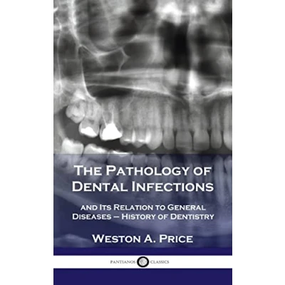 Abbildung von Pathology of Dental Infections: and Its Relation to General Diseases History Dentistry