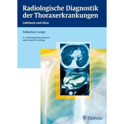 Abbildung von Radiologische Diagnostik der Thoraxerkrankungen