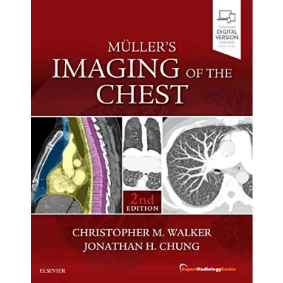 Abbildung von Muller&#039;s Imaging of the Chest: Expert Radiology Series