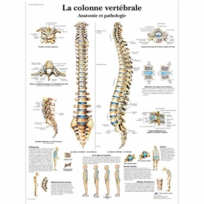 Abbildung von 3B Scientific Board, 1