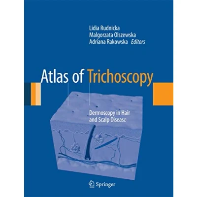 Abbildung von Atlas of Trichoscopy: Dermoscopy in Hair and Scalp Disease