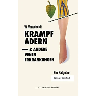Abbildung von Krampfadern und andere Venenerkrankungen: Ein Ratgeber (Leben Gesundheit)