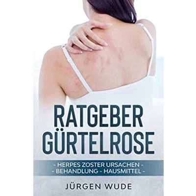 Abbildung von Ratgeber Gürtelrose: Herpes Zoster Ursachen Behandlung Hausmittel