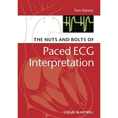 Abbildung von The Nuts and Bolts of Paced ECG Interpretation (Nuts Series (Replaced by 5113))