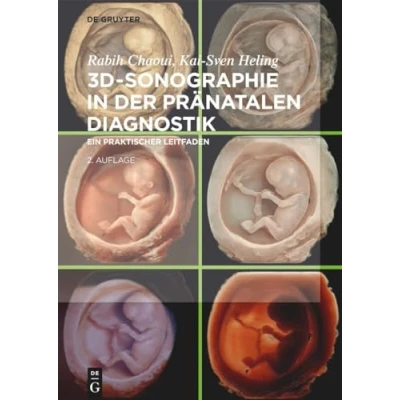 Abbildung von 3D Sonographie in der pränatalen Diagnostik: Ein praktischer Leitfaden