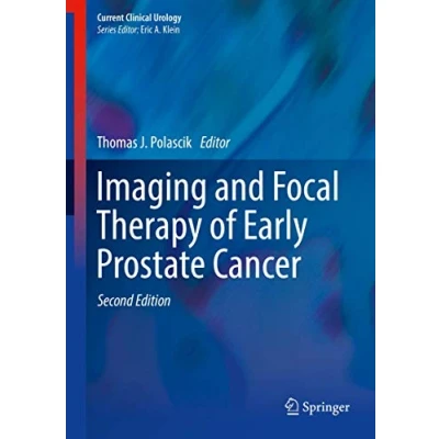 Abbildung von Imaging and Focal Therapy of Early Prostate Cancer (Current Clinical Urology)