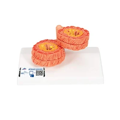 Abbildung von 3B Scientific Menschliche Anatomie COPD Modell + kostenlose App Smart Anatomy