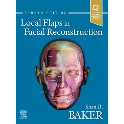 Abbildung von Local Flaps in Facial Reconstruction