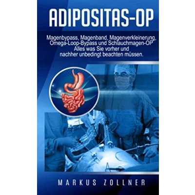 Abbildung von Adipositas OP: Magenbypass, Magenband, Magenverkleinerung, Omega Loop Bypass und Schlauchmagen OP Alles was Sie vorher nachher unbedingt beachten müssen.