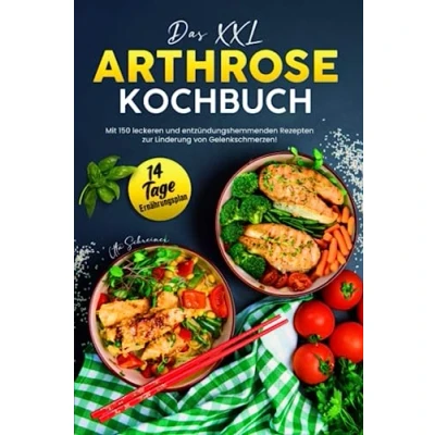 Abbildung von Das XXL Arthrose Kochbuch: Mit 150 leckeren und entzündungshemmenden Rezepten zur Linderung von Gelenkschmerzen! Inkl. 14 Tage Ernährungsplan
