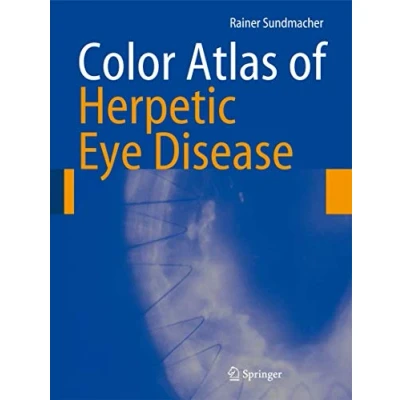 Abbildung von Color Atlas of Herpetic Eye Disease: A Practical Guide to Clinical Management