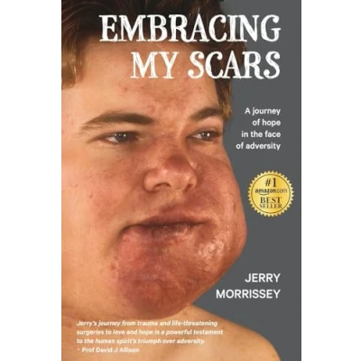 Abbildung von Embracing My Scars: A journey of hope in the face adversity
