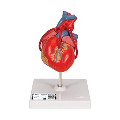 Abbildung von 3B Scientific Menschliche Anatomie Klassik Herz mit Bypass, 2 teilig + kostenlose App Smart Anatomy