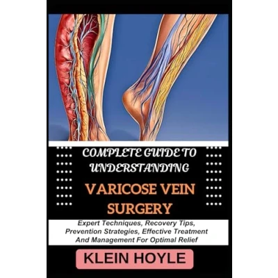 Abbildung von COMPLETE GUIDE TO UNDERSTANDING VARICOSE VEIN SURGERY: Expert Techniques, Recovery Tips, Prevention Strategies, Effective Treatment And Management For Optimal Relief