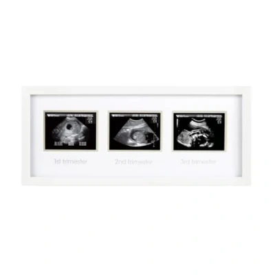 Abbildung von Pearhead 87038 Trimester Sonogram Frame Deluxe, Fotorahmen für drei Ultraschallaufnahmen, weiß