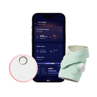 Abbildung von Owlet Baby Care DE Video Babyphone Dream Sock Medizinisch zertifiziertes Pulsoximeter, Herzfrequenz, Sauerstoffsättigung &amp; Schlaftrends via App