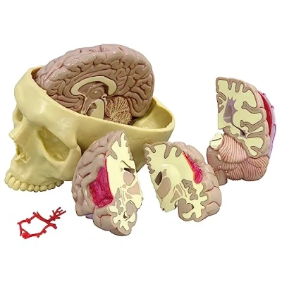 Abbildung von GPI Anatomicals 2900 Gehrin Modell