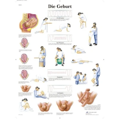 Abbildung von 3B Scientific Lehrtafel Die Geburt, VR0555UU