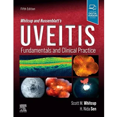 Abbildung von Whitcup and Nussenblatt&#039;s Uveitis: Fundamentals Clinical Practice