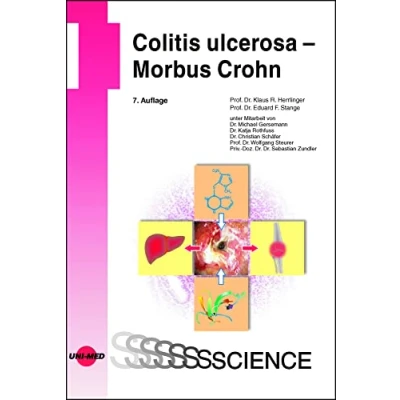 Abbildung von Colitis ulcerosa Morbus Crohn (UNI MED Science)