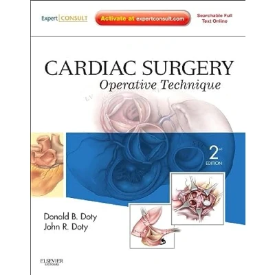 Abbildung von Cardiac Surgery: Operative Technique Expert Consult: Online and Print