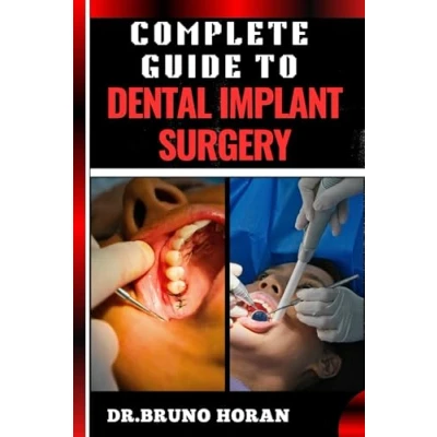 Abbildung von COMPLETE GUIDE To DENTAL IMPLANT SURGERY: Comprehensive Manual Advanced Techniques, Recovery, and Best Practices for Optimal Oral Health