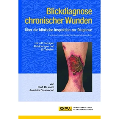Abbildung von Blickdiagnose chronischer Wunden: Über die klinische Inspektion zur Diagnose