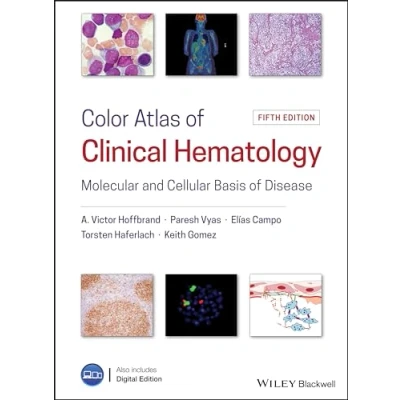 Abbildung von Color Atlas of Clinical Hematology: Molecular and Cellular Basis Disease