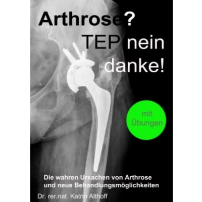 Abbildung von Arthrose? TEP nein danke!: Die wahren Ursachen von Arthrose und neue Behandlungsmöglichkeiten