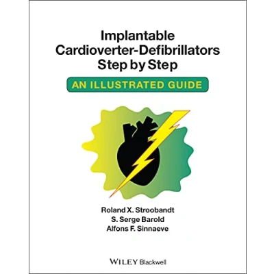 Abbildung von Implantable Cardioverter Defibrillators Step by Step: An Illustrated Guide