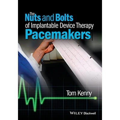 Abbildung von The Nuts and Bolts of Implantable Device Therapy: Pacemakers