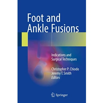 Abbildung von Foot and Ankle Fusions: Indications Surgical Techniques