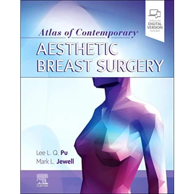 Abbildung von Atlas of Contemporary Aesthetic Breast Surgery: A Comprehensive Approach