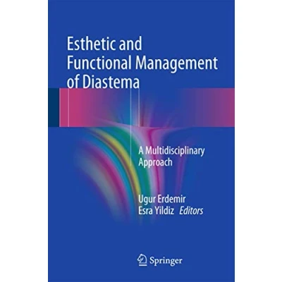 Abbildung von Esthetic and Functional Management of Diastema: A Multidisciplinary Approach
