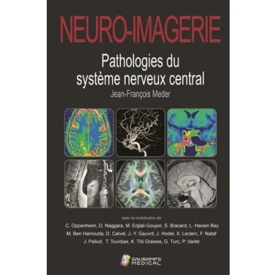 Abbildung von NEURO IMAGERIE. Pathologies du SYSTEME nerveux central 2ED: système