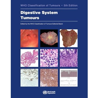 Abbildung von Digestive System Tumours: Who Classification of Tumours (World Health Organization Tumours, 1, Band 1)
