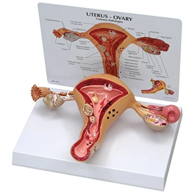 Abbildung von GPI Anatomicals W33352 Uterus Modell