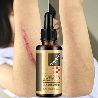 Abbildung von Allbesta Scar Repair Serum Lavender Essence Essential Oil Skin Care Natural Pure Remove Acne Burn Stretch Marks Removal 10ML