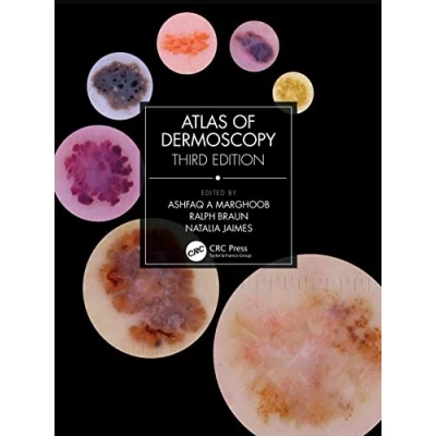 Abbildung von Atlas of Dermoscopy: Third Edition