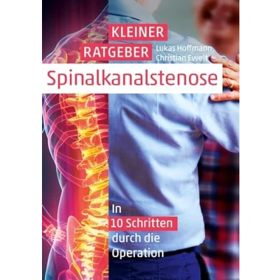 Abbildung von Kleiner Ratgeber Spinalkanalstenose: In 10 Schritten durch die Operation